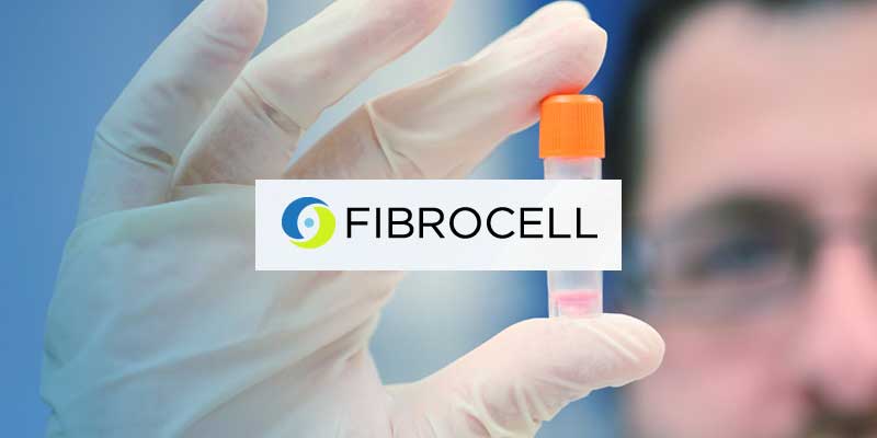 Fibrocell to Present at Phacilitate Leaders World 2019