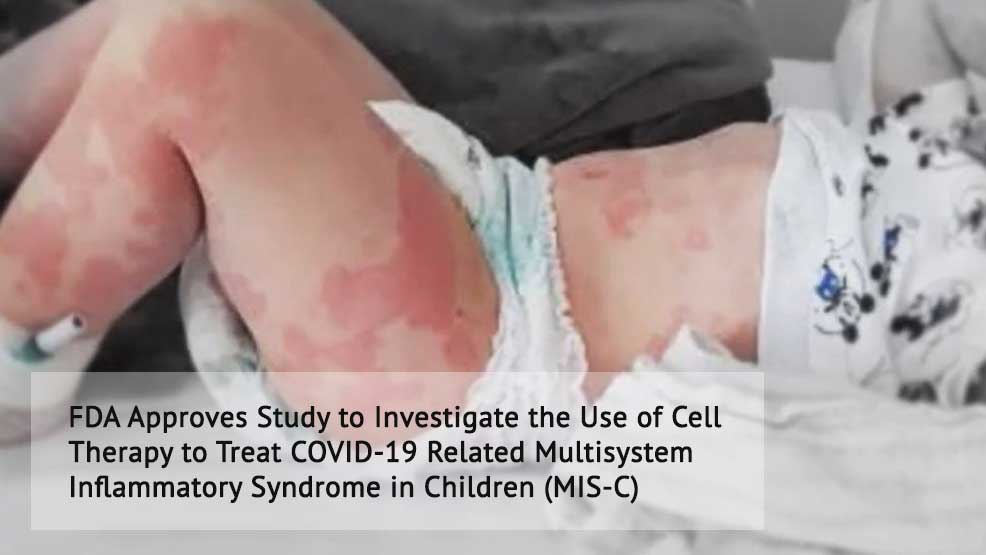 FDA Approves Study to Investigate the Use of Cell Therapy to Treat COVID-19 Related Multisystem Inflammatory Syndrome in Children (MIS-C)